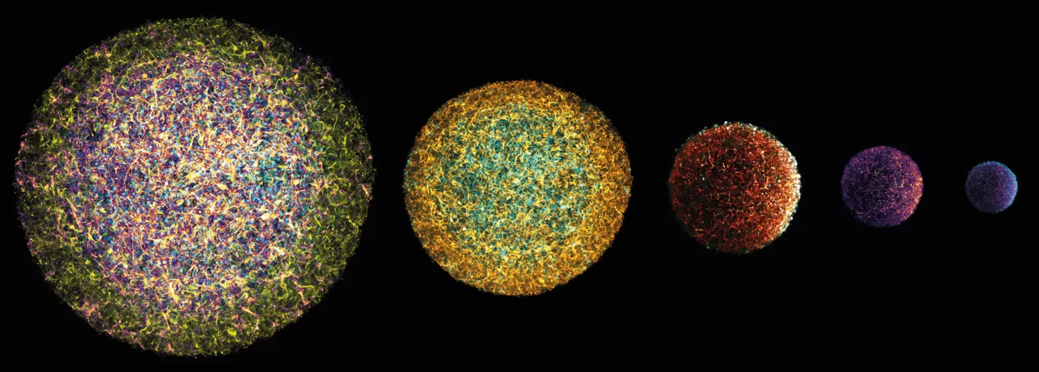 The image depicts 3D spheroids (‘neuroids’) derived from the spinal cord neural stem cells.