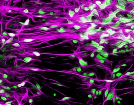 15 million for research on cell therapy for Parkinson’s disease | The ...