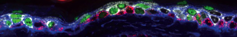 Microscopy images illustrating. Stem cells are in red and differentiating cells in white or green.