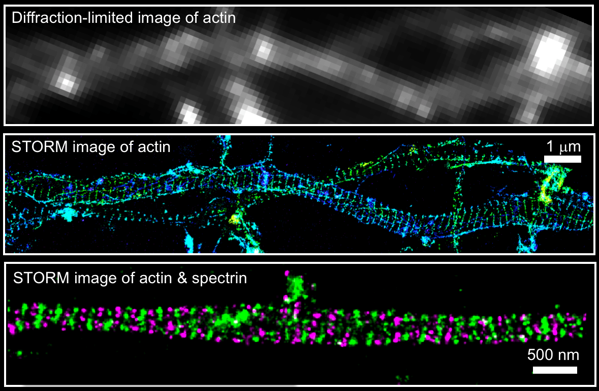 Periodiskt membranskelett i neuroner som upptäckts med hjälp av STORM. Foto: Xiaowei Zhuang 