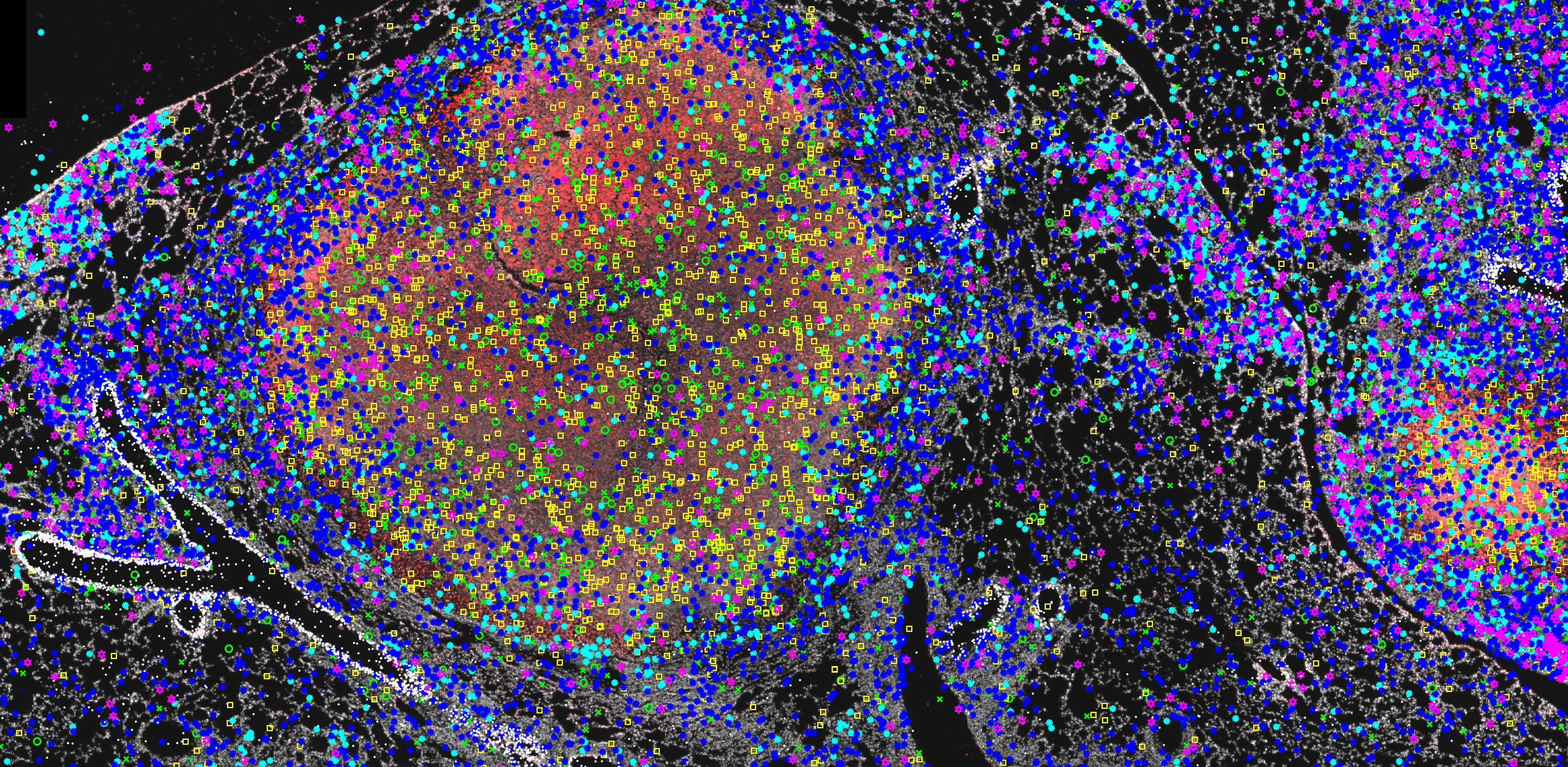 Immunsvar på TBC-infektion, credit Carow et al. 