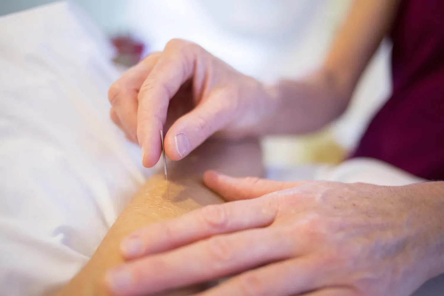 Hand seting a acupucture needle.