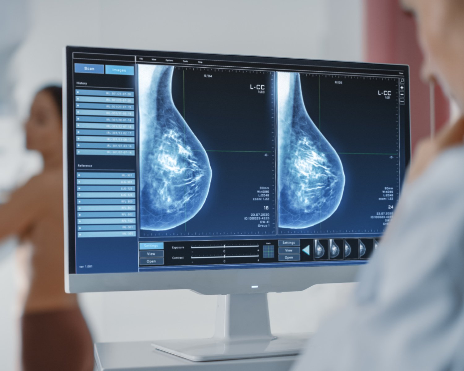 Woman undergoing mammographic screening while the doctors looks at the images on the computer screen in hospital radiology room