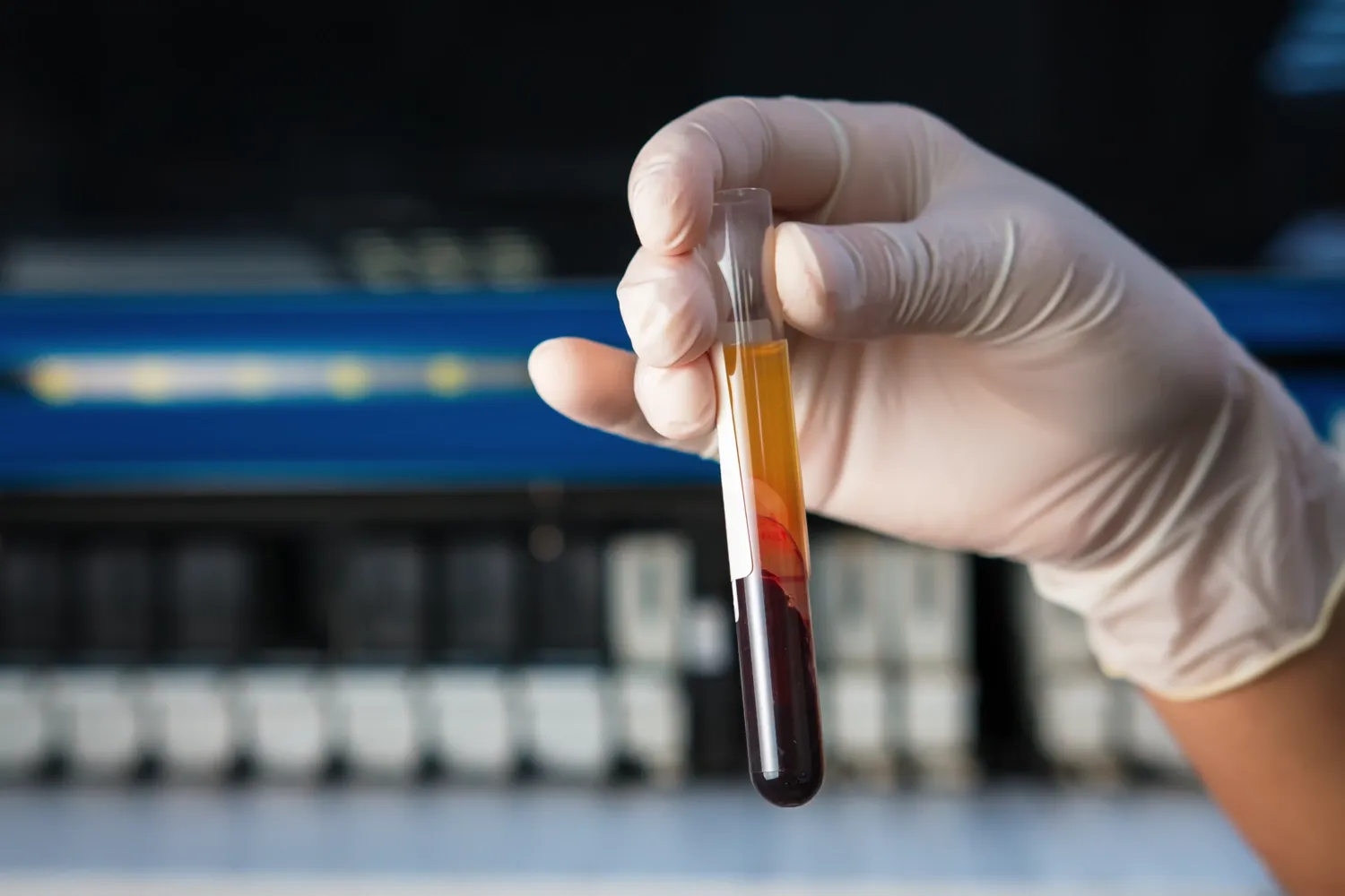 A hand in a plastic glove holding a blood tube at a microbiology laboratory.