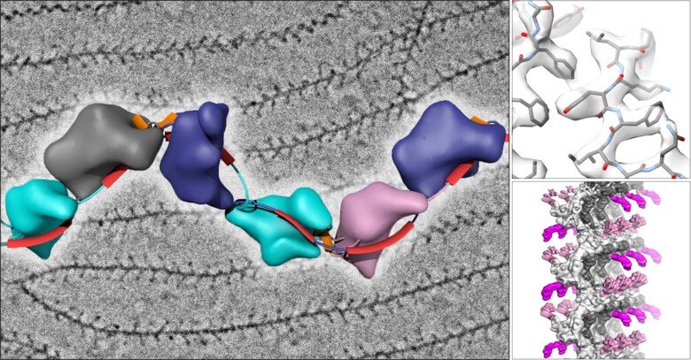 Illustration of the protein in blue, grey and pink