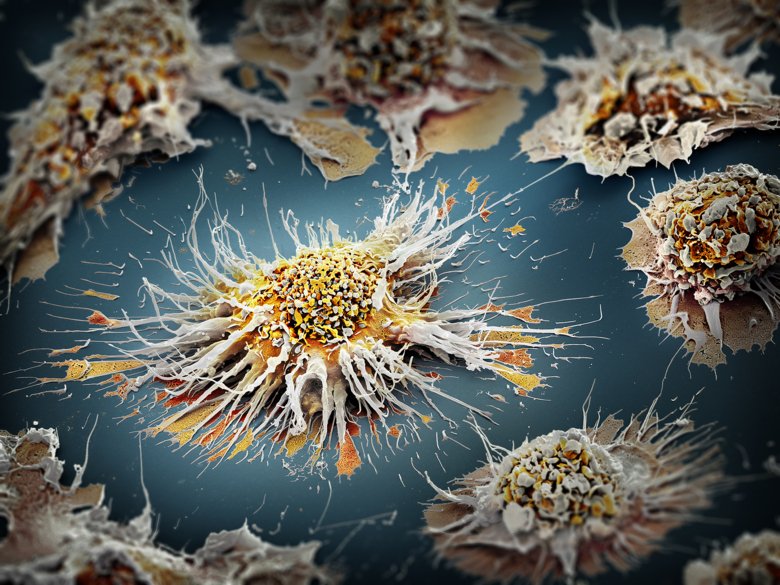 This hand-colored scanning electron micrograph shows the star-like shape of an activated dendritic cell and its interactions with surrounding cells.
