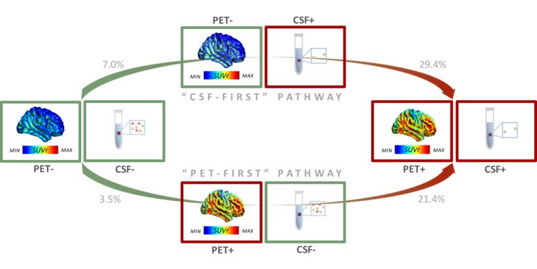 Illustration of CSF and PET for early diagnosis of ALzheimer's disease.