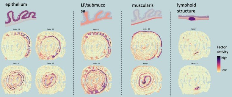 Figure showing gene expression programs in specific compartment of the murine colon. Credit: Ludvig Larsson.