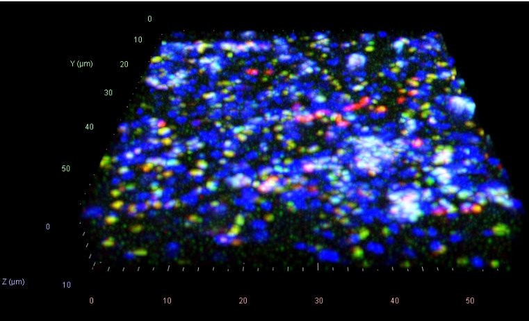3D observation. Two images with dark background and lighter fields in blue.