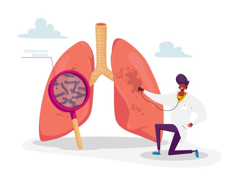 Lungs infected with tuberculosis