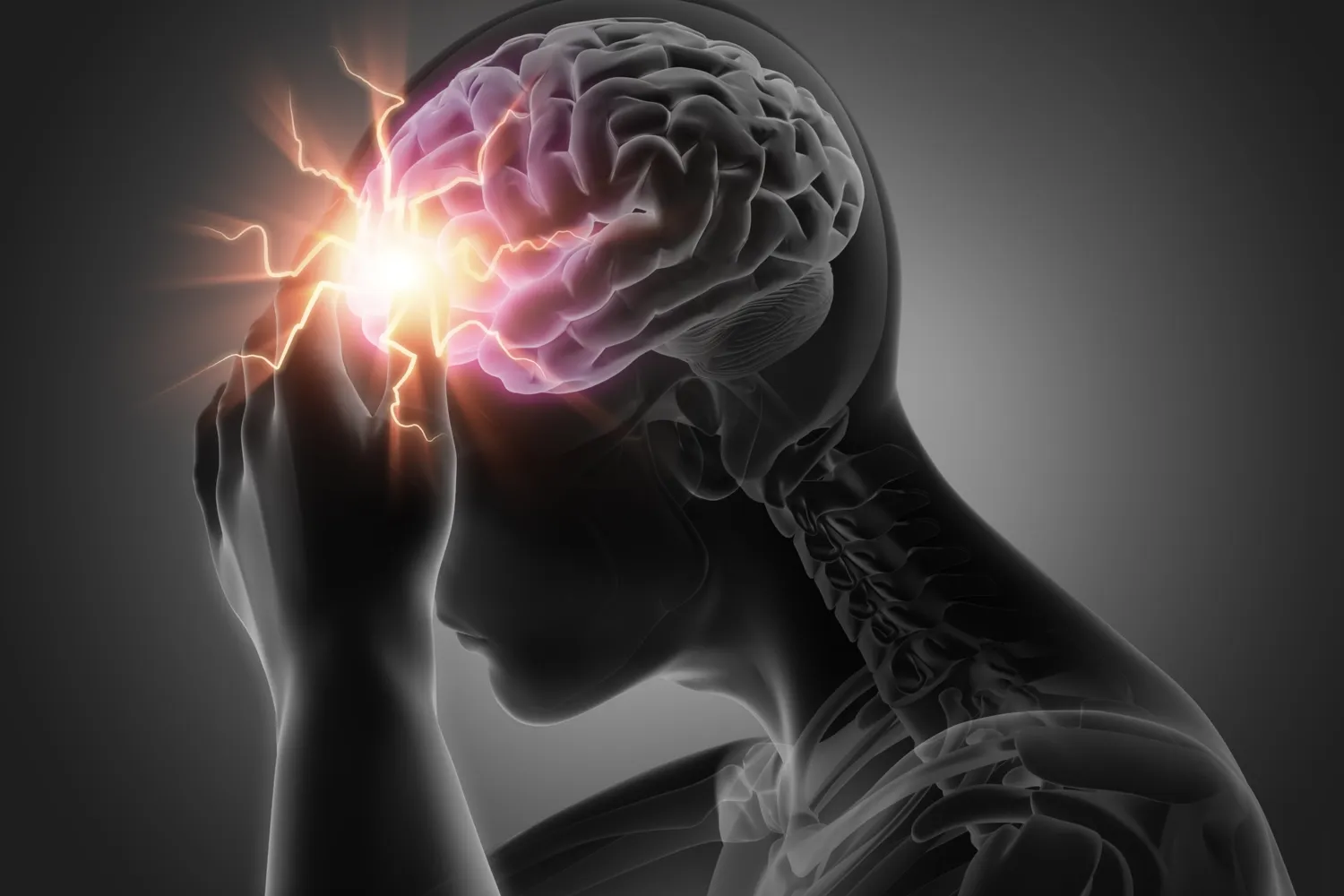 Decorative: Man with heavy headache or brain stroke - conceptual artwork - 3d illustration - Gray scale Image