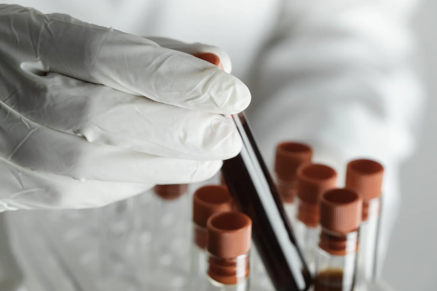 Test tubes containing blood samples.