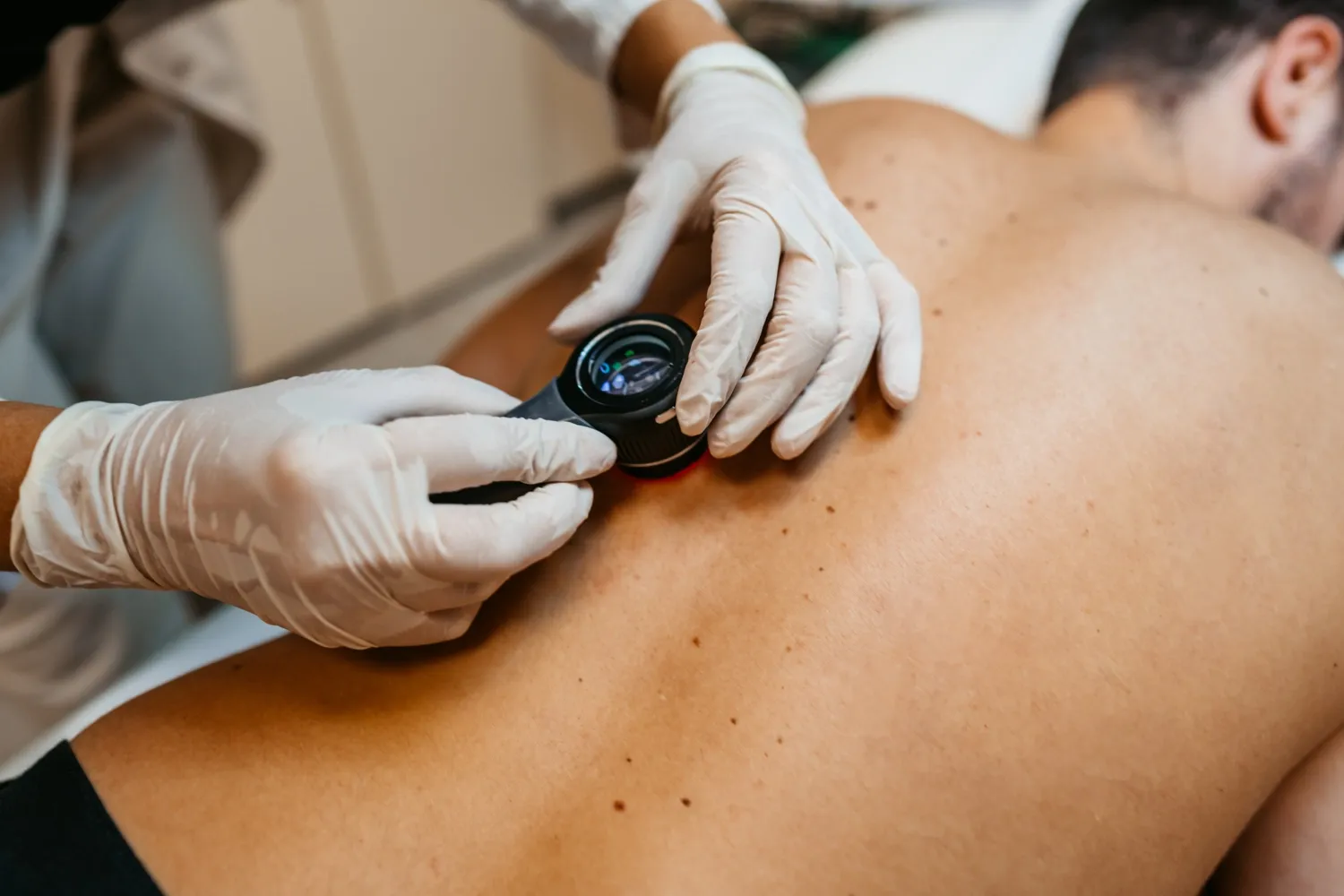 Doctor examining patients birth marks on the back.