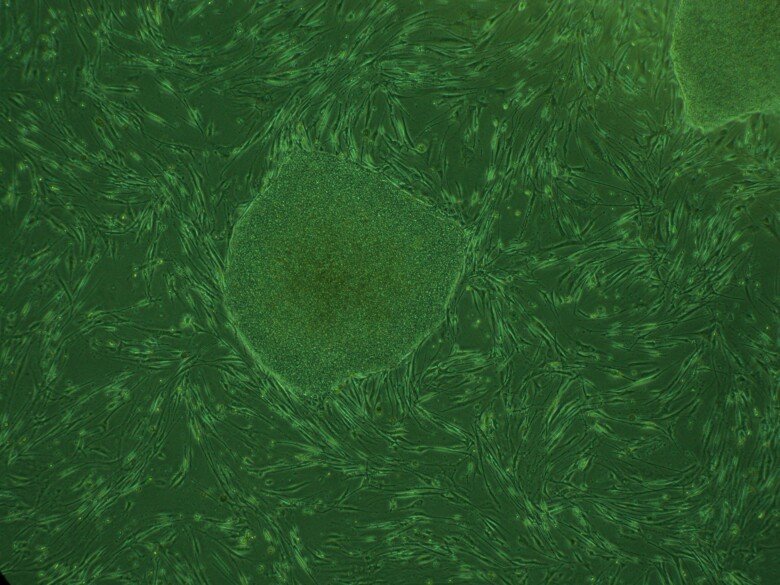 A green microscope image with lighter areas showing the cells.