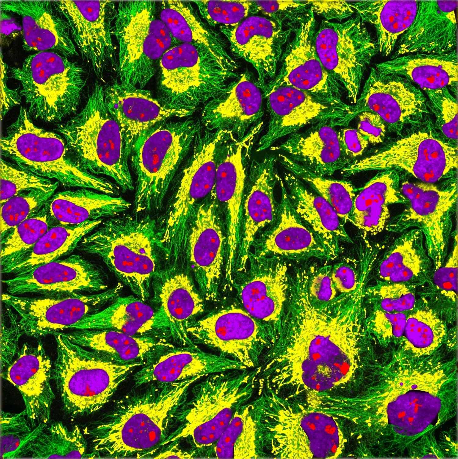 HeLa-cells