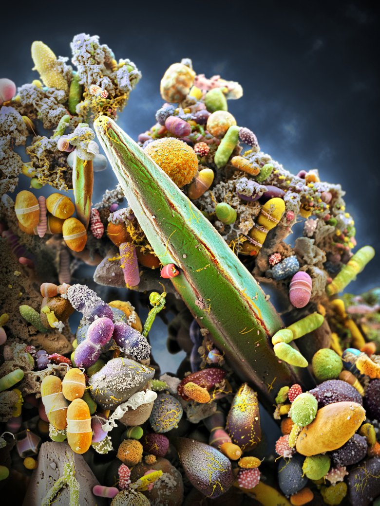 Artistic coloration of the microbiome present in a human gut.