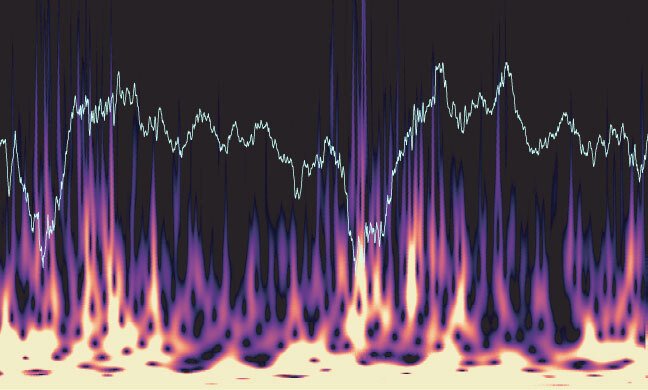 Spectrogram illustrating brain oscillations. The superimposed cyan trace shows the corresponding raw local field potential trace.