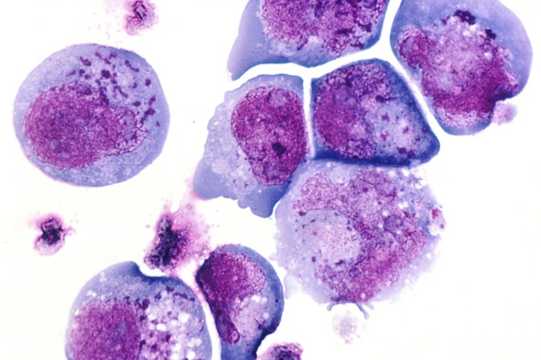Scientific image of cells infected by human herpes virus.