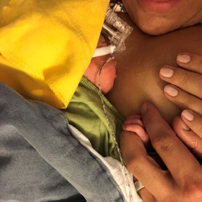 Newborn baby receiving skin-to-skin contact