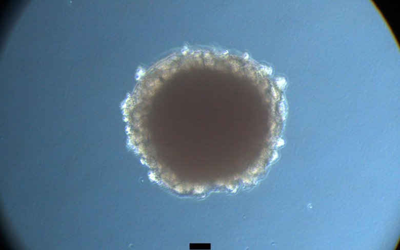 Kidney organoid