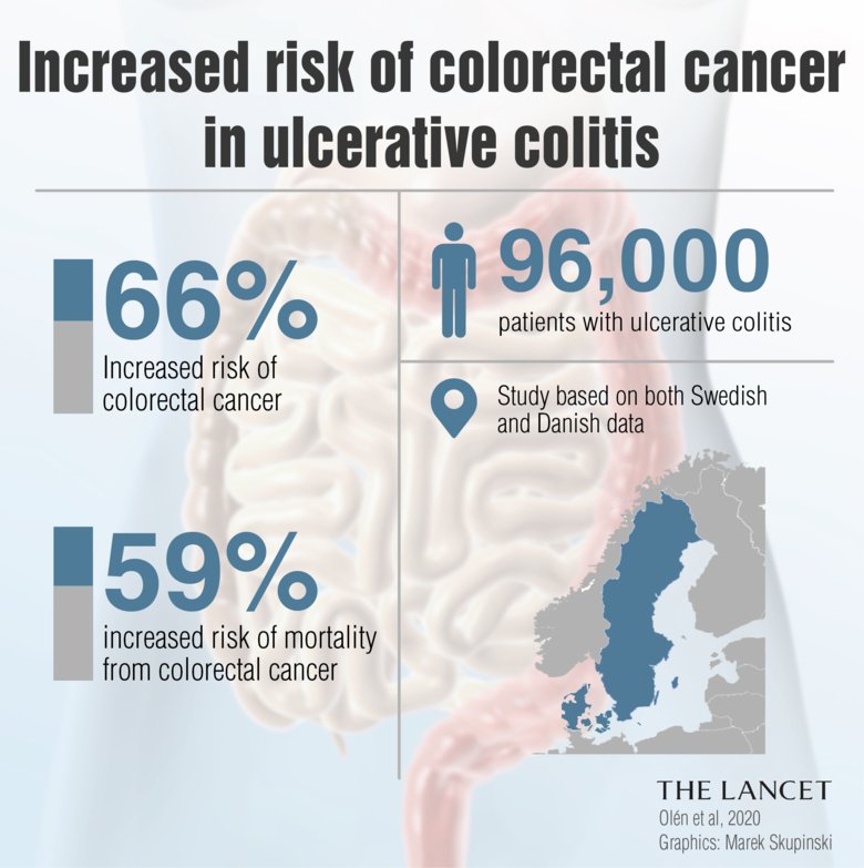 Illustration av colorectal cancer risk for ulcerative colitis patients.