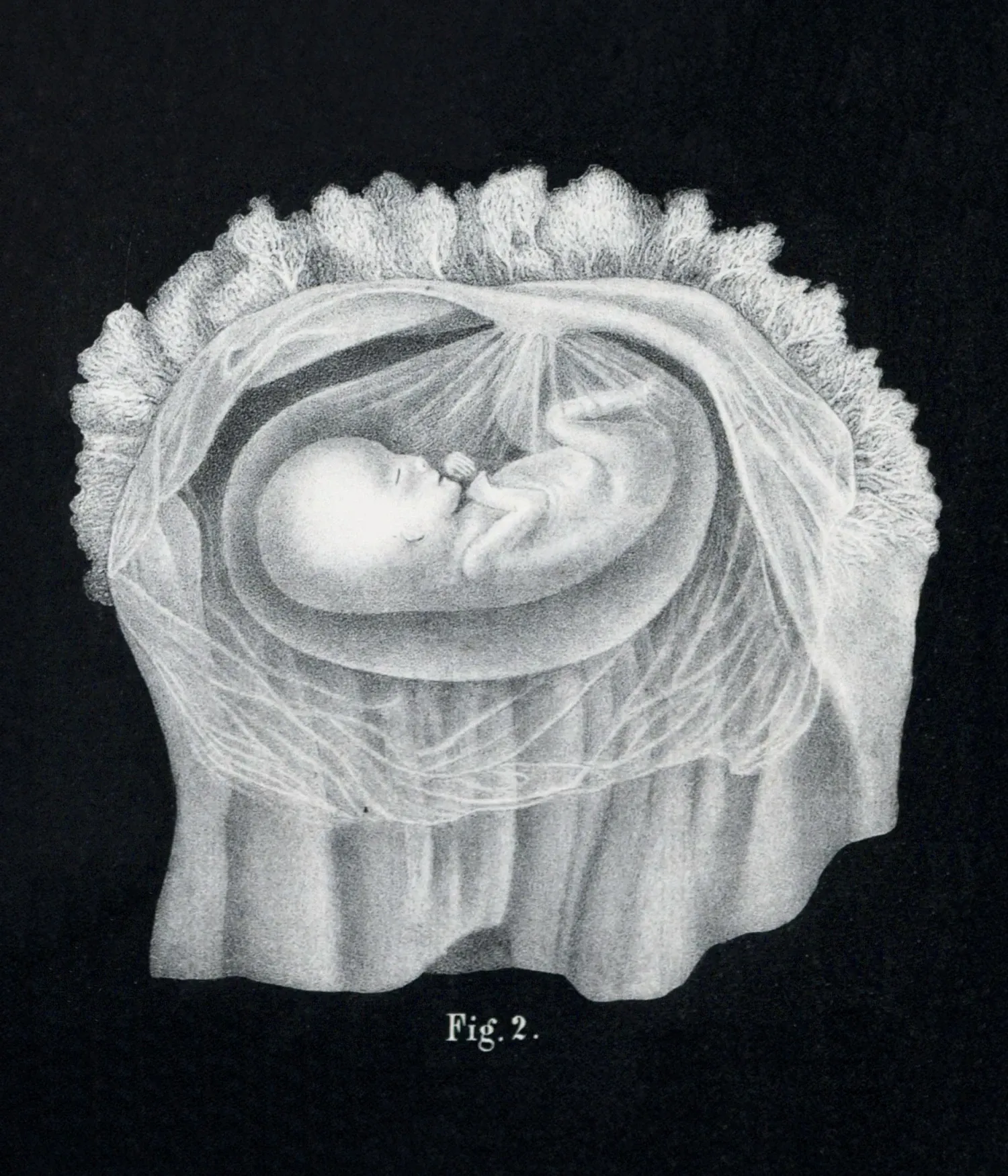 Vernissage: The Fragility of Life