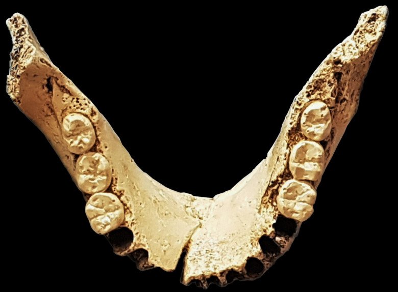 Old jawbone with teeth.