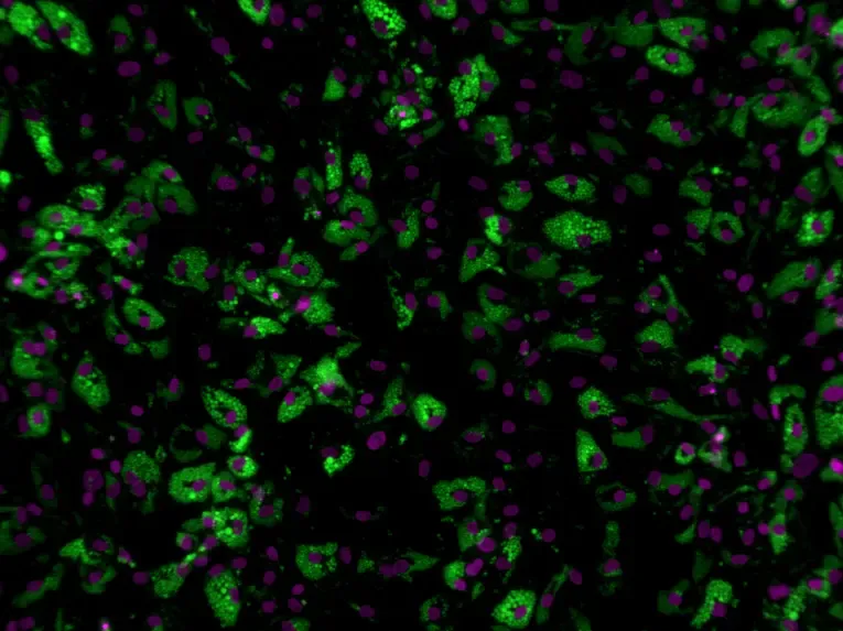 Microscope image of fat cells. Black background with green and purple dots.