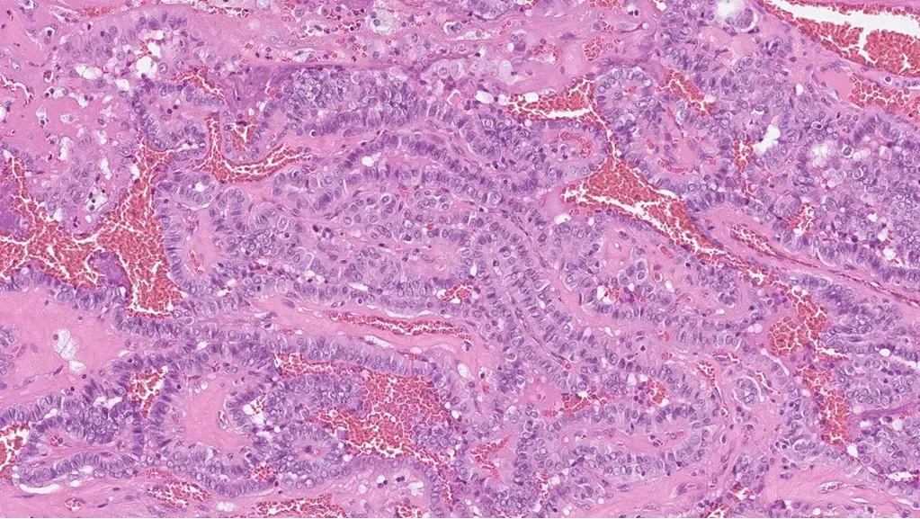 Histological image of cells in the thyroid.