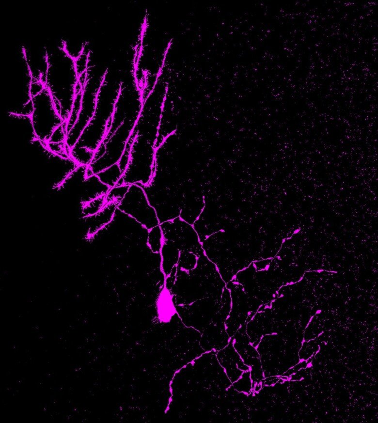 images showing Purkinje cell morphology (in zebrafish)