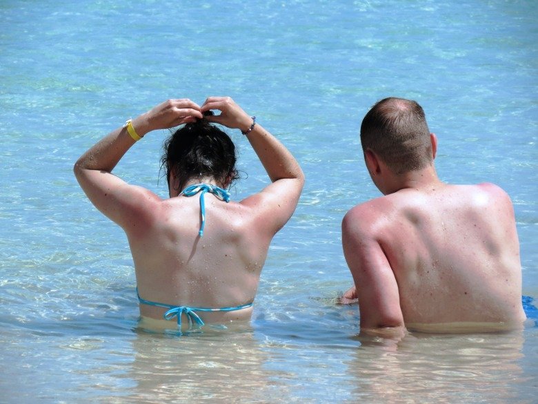A man and a woman in a swimming pool, they are both burned from the sun.