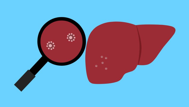Illustration of a liver and a magnifying glass, hepatitis C.