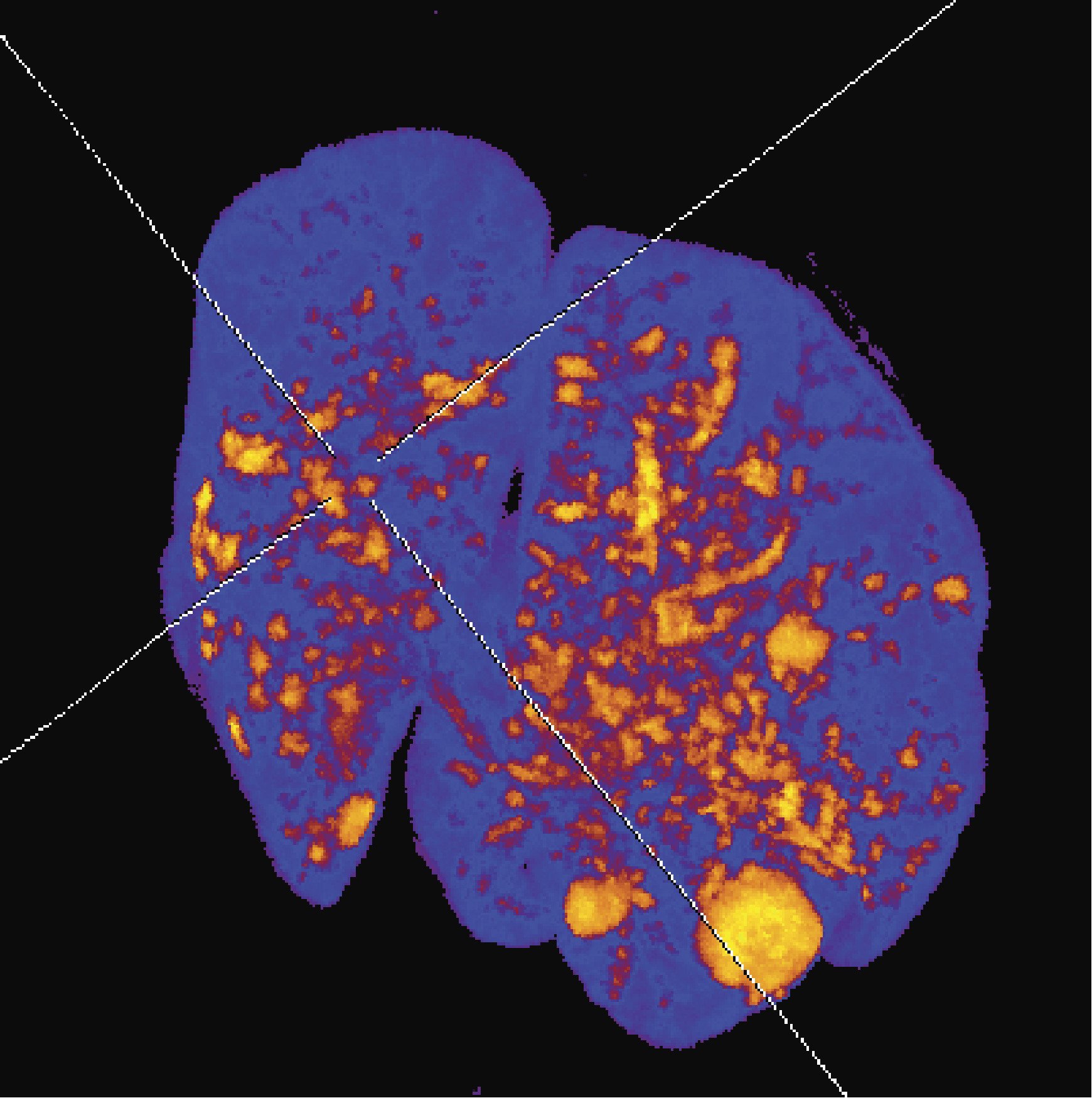 microCT @KERIC