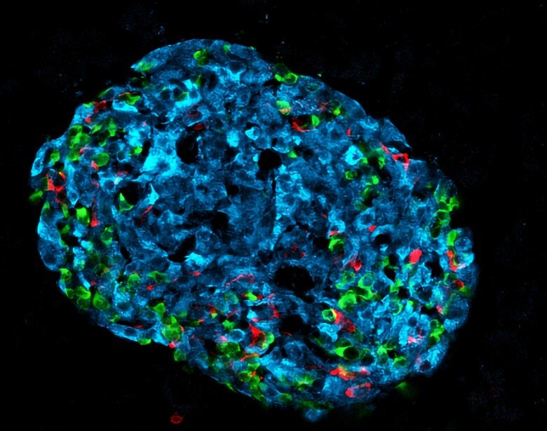 Illustration of a pancreatic islet.