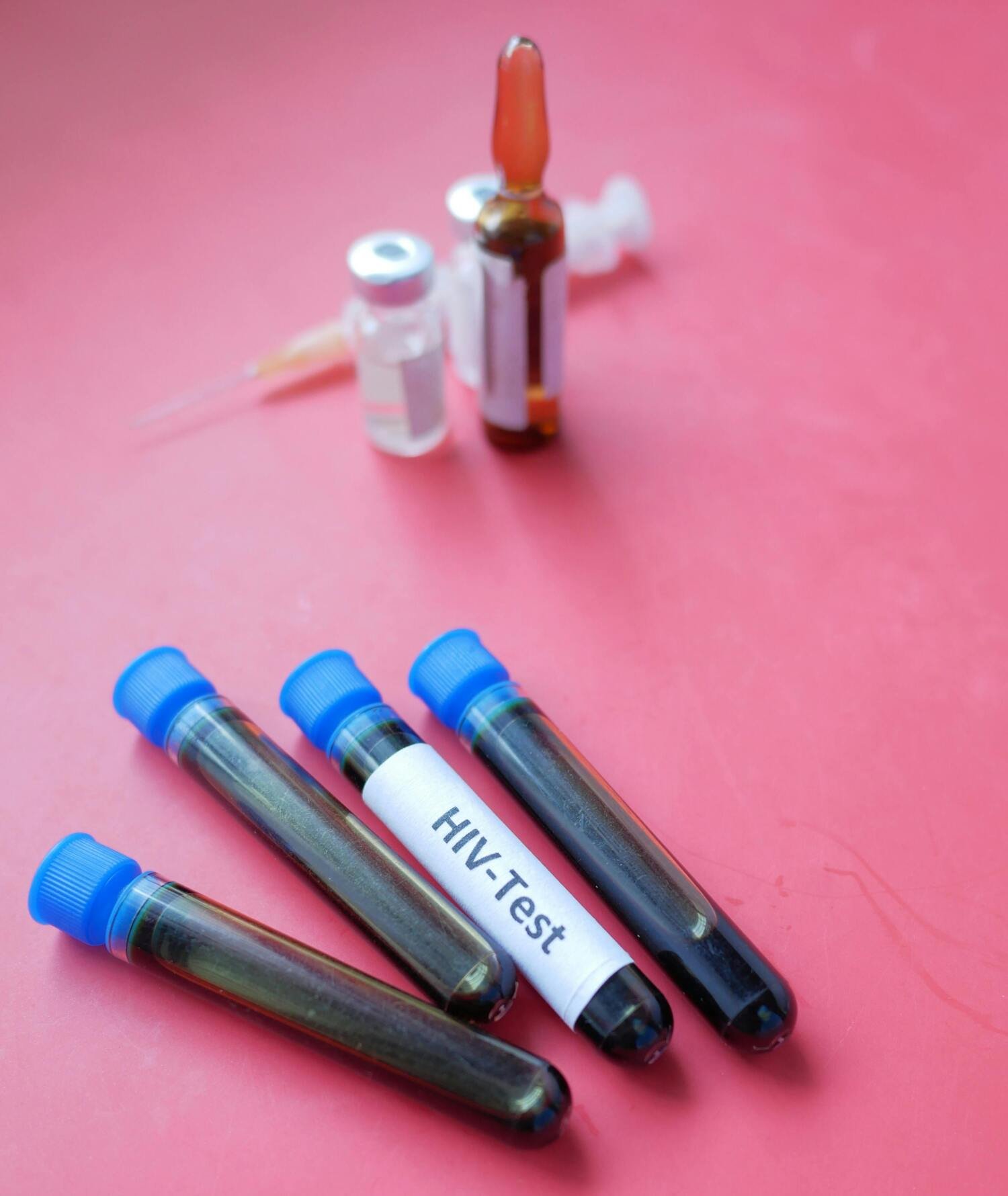 blood vials and tests for hiv