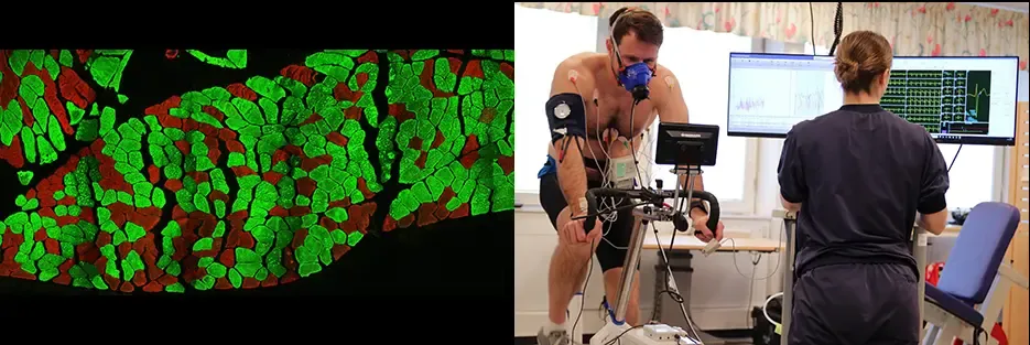 235 / 5,000 Two side-by-side photographs, one of which shows a section of muscle stained with immunohistochemistry, showing which muscles are fast and slow. The second image shows a test subject doing a work test on a test cycle.