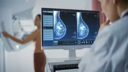Woman undergoing mammographic screening while the doctors looks at the images on the computer screen in hospital radiology room