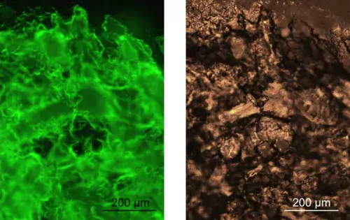 The hydrogels stained with a fluorescent dye that binds to amyloid structures and the corresponding brightfield image.