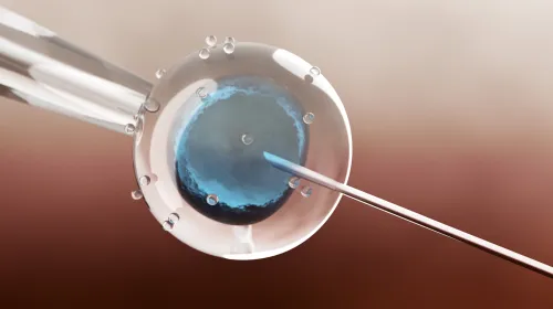 Illustration of in vitro fertilisation of egg cell.