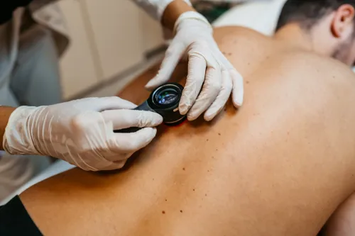 Doctor examining patients birth marks on the back.
