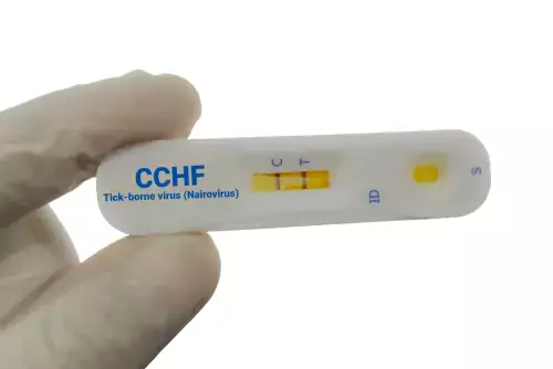 Rapid test for CCHF virus (Crimean-Congo haemorrhagic fever virus).