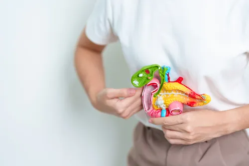 Woman holding human Pancreatitis anatomy model.