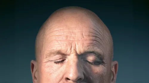 Bold head of a man