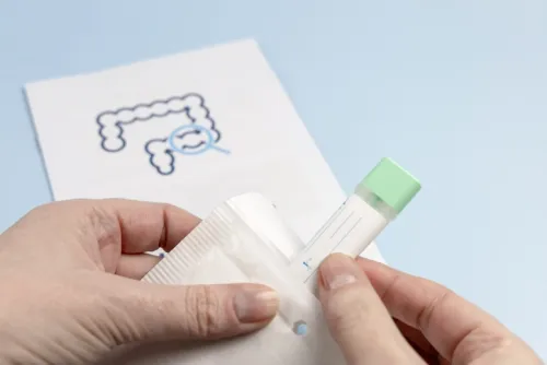 home test for colorectal cancer screening