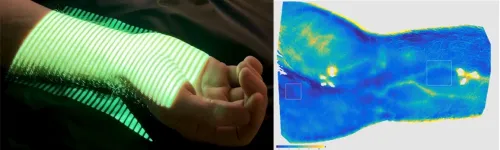 Evaluating microvascular function with a non-invasive light-based method