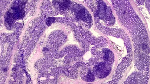 Histological image from a murine inflamed colon wit different colours.