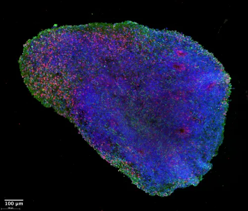 A brain organoid after exposure, showing an abundance of inhibitory neurons (in green).