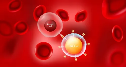 CAR T cell therapy involves genetically modifying the patient&#039;s own T-cells to be able to attack cancer cells. The illustration shows a cancer cell and a modified T cell.